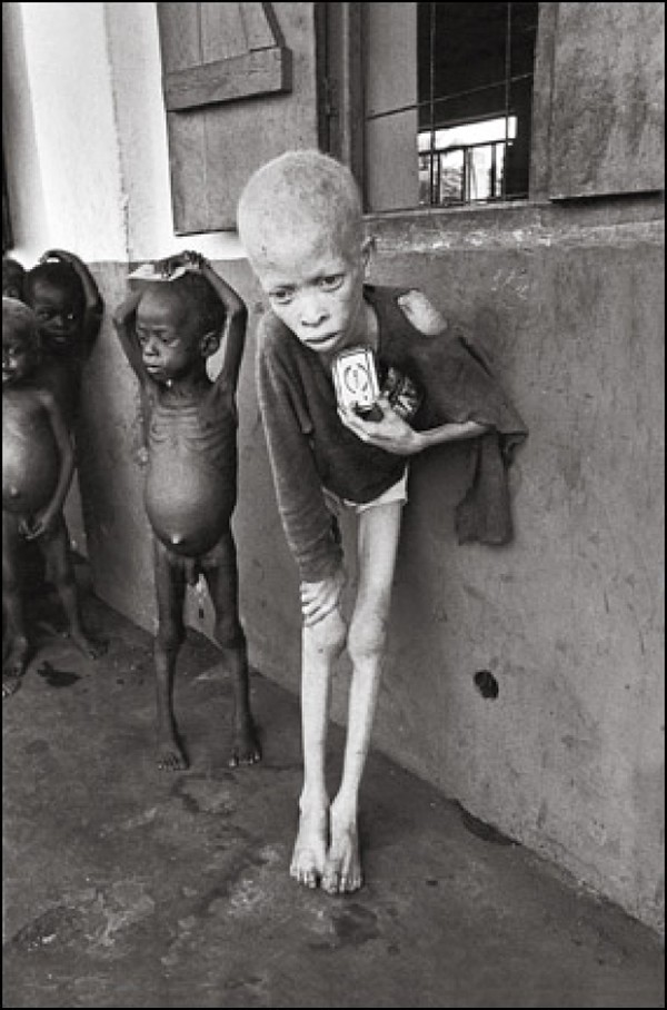 Nhiếp ảnh gia người Anh Don McCullin chụp những đứa trẻ trong trại tập trung ở Biafra. Chúng đang đứng giữa ranh giới sự sống và cái chết. Quốc gia này phải trải qua cuộc chiến tranh kéo dài suốt 3 năm. Hơn một triệu người chết, nạn đói và dịch bệnh hoành hành khắp nơi.